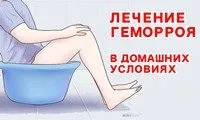 як лікувати геморой при вагітності