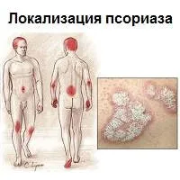 дієта