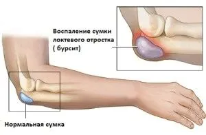 лікування