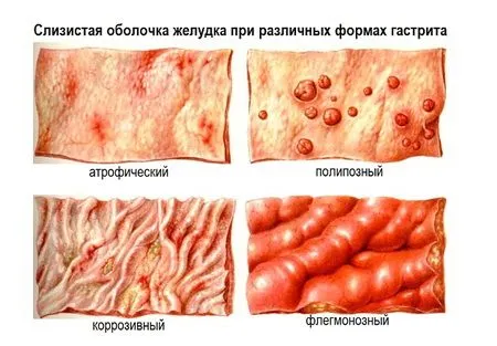 різні