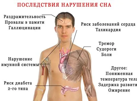 Як швидко заснути? Причини безсоння як швидко вилікувати безсоння