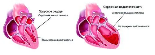 чи можна вилікувати печінку голодуванням