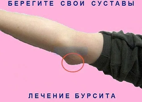 суглоб