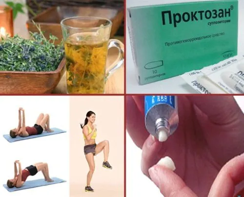 як лікувати геморой при вагітності
