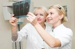 як лікувати розпухлі суглоби