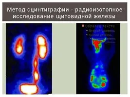 як лікувати тиск содою