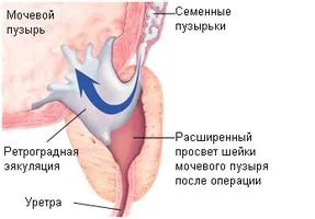 як лікувати тиск содою