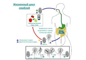 як вилікувати хронічний лямбліоз
