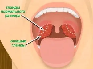 що робити