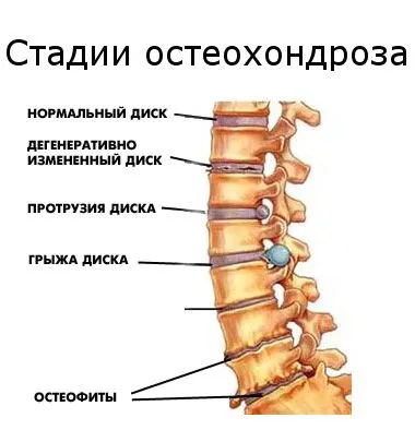 симптоми
