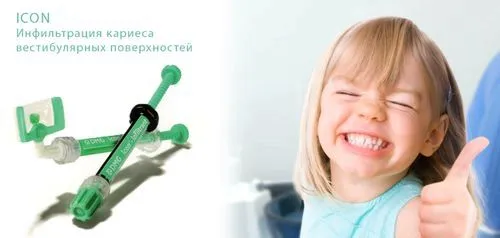 як вилікувати карієс без свердління