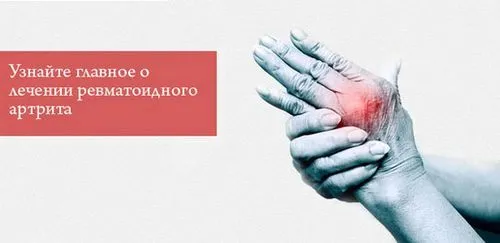 як лікувати ревматоїдний артрит