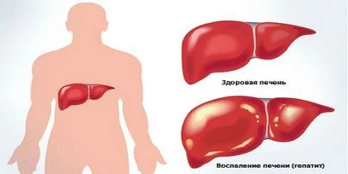якщо не лікувати печінку