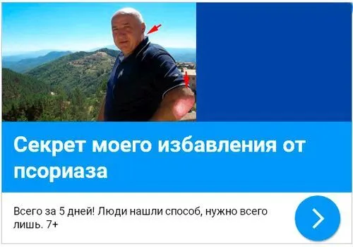 як вилікувати псоріаз раз і назавжди