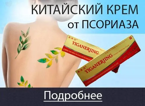Мазі від псоріазу - огляд як лікувати псоріаз мазь