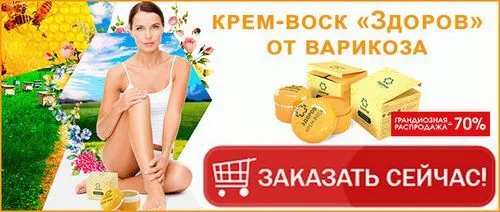 як лікувати варикоз вен на руках
