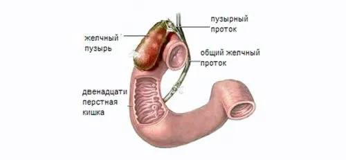 Гострий холецистит як лікувати гострий холецистит
