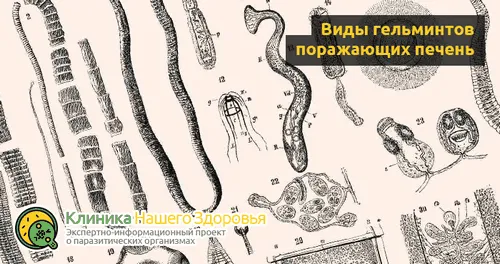 як лікувати печінку від паразитів