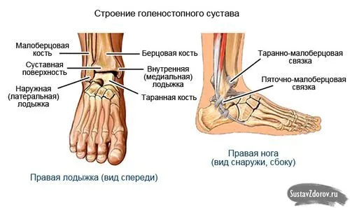 як лікувати розтягнення голеностопа