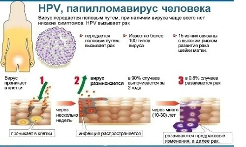 як лікувати вірус папіломи 33
