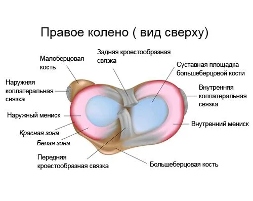 розрив меніска біль операція артроскопія хірургія