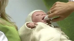 молочниця мову немовля лікування