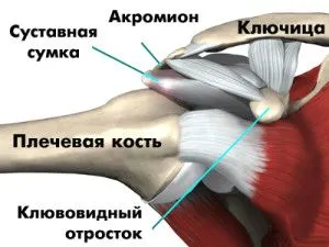 ревматизм плечового суглоба причини симптоми лікування