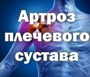 лікувати артроз плеча