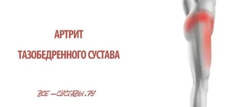 як лікують тазостегновий суглоб