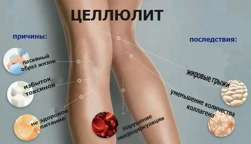 як лікувати целюліт будинку