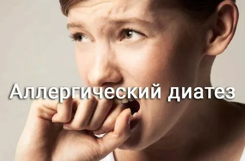 як лікувати алергічний діатез