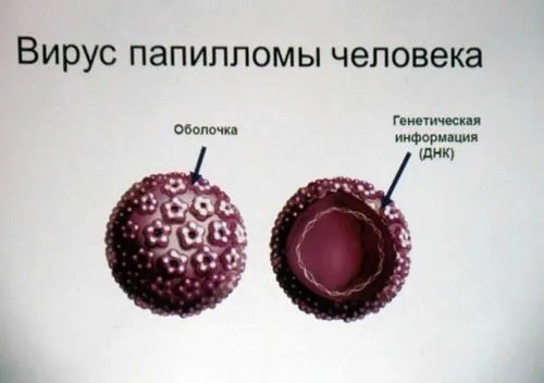 як вилікувати бородавку під нігтем