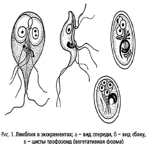 як лікувати хронічний лямбліоз
