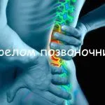 як лікувати радикуліт вправи