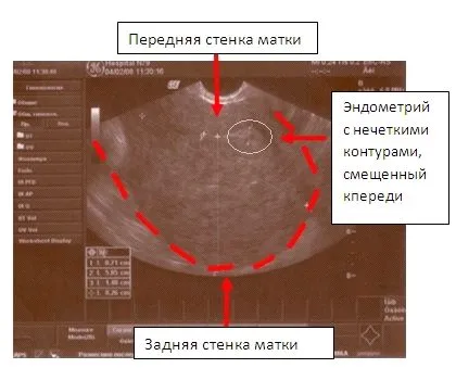 опис
