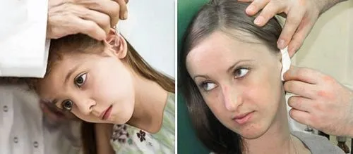 як лікувати вуха у людини