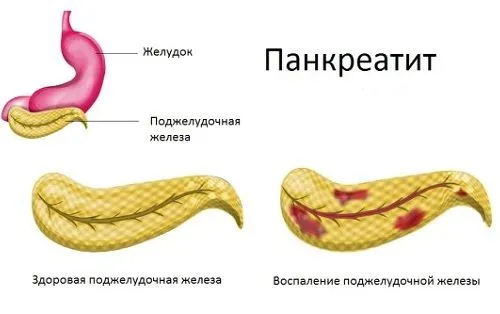 як лікувати нирки після фуросеміду