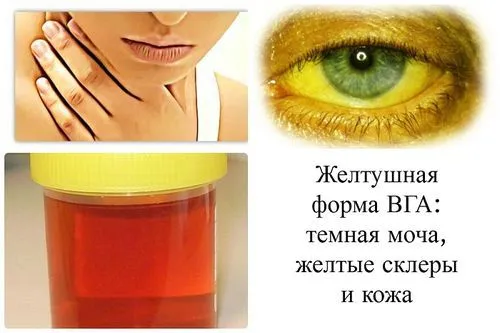 гепатит а лікується чи ні