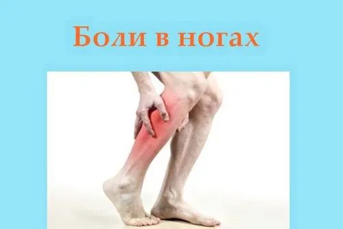 як лікувати радикуліт вправи