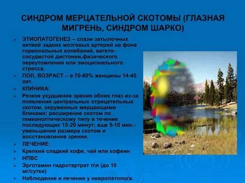 як лікувати очну мігрень