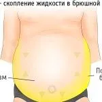 як вилікувати рак яєчників