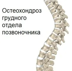 як лікувати остеохондроз і сколіоз