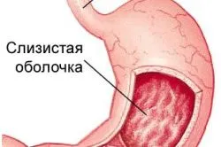 вилікувати гастрит перекисом водню