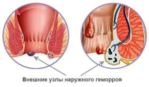 вид