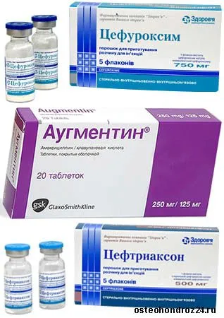як лікувати отит дорослому