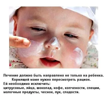 діатез у грудних дітей
