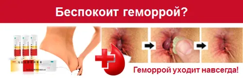вилікувати геморой народними засобами