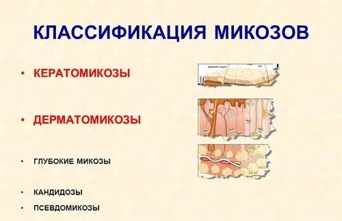як лікувати кандидоз шкіри голови