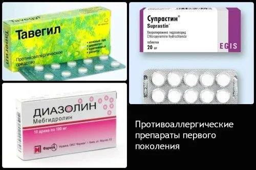 як лікувати медикаментозну кропивницю