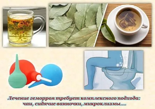 вилікувати геморой народними засобами